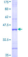 Complement C4b Protein - 12.5% SDS-PAGE Stained with Coomassie Blue.