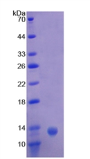Complement C4b Protein - Recombinant Complement Component 4b By SDS-PAGE