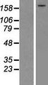 Complement C5 Protein - Western validation with an anti-DDK antibody * L: Control HEK293 lysate R: Over-expression lysate