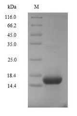 Complement C5 Protein - (Tris-Glycine gel) Discontinuous SDS-PAGE (reduced) with 5% enrichment gel and 15% separation gel.