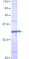 Complement C5 Protein - 12.5% SDS-PAGE Stained with Coomassie Blue.
