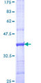 Complement C5 Protein - 12.5% SDS-PAGE Stained with Coomassie Blue.