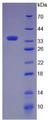 Complement C5a Protein - Recombinant Complement Component 5a By SDS-PAGE