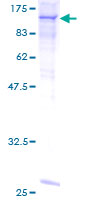 Complement C6 Protein - 12.5% SDS-PAGE of human C6 stained with Coomassie Blue