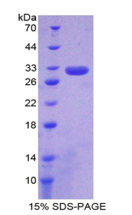 Complement C6 Protein - Recombinant Complement Component 6 By SDS-PAGE