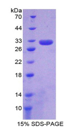 Complement C6 Protein - Recombinant Complement Component 6 By SDS-PAGE