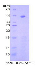 Complement C8b Protein - Recombinant Complement Component 8b By SDS-PAGE