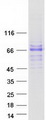 Complement C8b Protein - Purified recombinant protein C8B was analyzed by SDS-PAGE gel and Coomassie Blue Staining