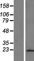 Complement C8g Protein - Western validation with an anti-DDK antibody * L: Control HEK293 lysate R: Over-expression lysate