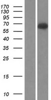 Complement C9 Protein - Western validation with an anti-DDK antibody * L: Control HEK293 lysate R: Over-expression lysate