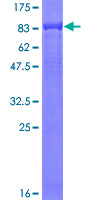 Complement C9 Protein - 12.5% SDS-PAGE of human C9 stained with Coomassie Blue