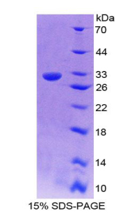 Complement C9 Protein - Recombinant Complement Component 9 By SDS-PAGE