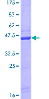 COMT Protein - 12.5% SDS-PAGE of human COMT stained with Coomassie Blue