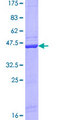 COMT Protein - 12.5% SDS-PAGE of human COMT stained with Coomassie Blue