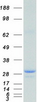 COMT Protein - Purified recombinant protein COMT was analyzed by SDS-PAGE gel and Coomassie Blue Staining
