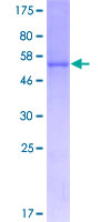 COMTD1 Protein - 12.5% SDS-PAGE of human COMTD1 stained with Coomassie Blue