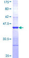 COPB1 / Beta-COP Protein - 12.5% SDS-PAGE Stained with Coomassie Blue.
