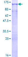 COPB2 / Beta-COP Protein - 12.5% SDS-PAGE of human COPB2 stained with Coomassie Blue