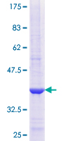 COPB2 / Beta-COP Protein - 12.5% SDS-PAGE Stained with Coomassie Blue.