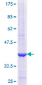 COPB2 / Beta-COP Protein - 12.5% SDS-PAGE Stained with Coomassie Blue.