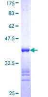 COPE Protein - 12.5% SDS-PAGE Stained with Coomassie Blue.