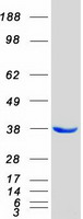 COPE Protein - Purified recombinant protein COPE was analyzed by SDS-PAGE gel and Coomassie Blue Staining