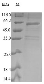 COPS2 / TRIP15 / ALIEN Protein - (Tris-Glycine gel) Discontinuous SDS-PAGE (reduced) with 5% enrichment gel and 15% separation gel.