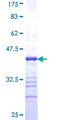 COPS3 / CSN3 Protein - 12.5% SDS-PAGE Stained with Coomassie Blue.