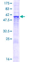 COPS6 / CSN6 Protein - 12.5% SDS-PAGE of human COPS6 stained with Coomassie Blue