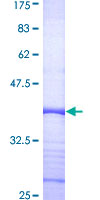 COPS6 / CSN6 Protein - 12.5% SDS-PAGE Stained with Coomassie Blue.