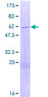 COPS7A Protein - 12.5% SDS-PAGE of human COPS7A stained with Coomassie Blue