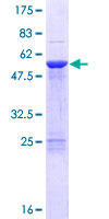COPS7B / CSN7B Protein - 12.5% SDS-PAGE of human COPS7B stained with Coomassie Blue