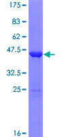 COPZ1 Protein - 12.5% SDS-PAGE of human COPZ1 stained with Coomassie Blue