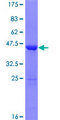 COPZ1 Protein - 12.5% SDS-PAGE of human COPZ1 stained with Coomassie Blue