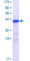 COPZ2 Protein - 12.5% SDS-PAGE of human COPZ2 stained with Coomassie Blue