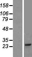 COQ10B Protein - Western validation with an anti-DDK antibody * L: Control HEK293 lysate R: Over-expression lysate