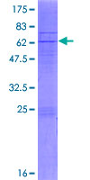 COQ2 Protein - 12.5% SDS-PAGE of human COQ2 stained with Coomassie Blue