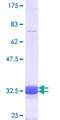COQ2 Protein - 12.5% SDS-PAGE Stained with Coomassie Blue.