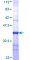 COQ3 Protein - 12.5% SDS-PAGE Stained with Coomassie Blue.