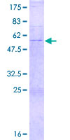 COQ4 Protein - 12.5% SDS-PAGE of human COQ4 stained with Coomassie Blue