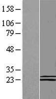 COQ6 Protein - Western validation with an anti-DDK antibody * L: Control HEK293 lysate R: Over-expression lysate