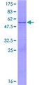 COQ7 Protein - 12.5% SDS-PAGE of human COQ7 stained with Coomassie Blue