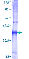 CORIN Protein - 12.5% SDS-PAGE Stained with Coomassie Blue.