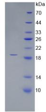 CORIN Protein - Recombinant Corin By SDS-PAGE