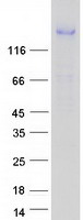 CORIN Protein - Purified recombinant protein CORIN was analyzed by SDS-PAGE gel and Coomassie Blue Staining
