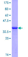 Corneodesmosin / CDSN Protein - 12.5% SDS-PAGE Stained with Coomassie Blue.