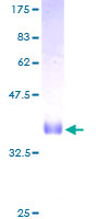 CORNIFIN / SPRR1B Protein - 12.5% SDS-PAGE of human SPRR1B stained with Coomassie Blue