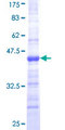 CORO1A / Coronin 1a Protein - 12.5% SDS-PAGE Stained with Coomassie Blue.