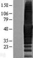 CORO1B Protein - Western validation with an anti-DDK antibody * L: Control HEK293 lysate R: Over-expression lysate