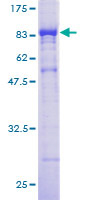 CORO1B Protein - 12.5% SDS-PAGE of human CORO1B stained with Coomassie Blue